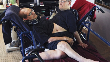 World’s longest-surviving conjoined twin brothers die at 68