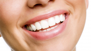 Ways to whiten your teeth