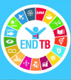 We must be bold to end TB by 2030