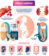 Pre-Eclampsia: A Concerning Condition for Maternal Health in Nepal