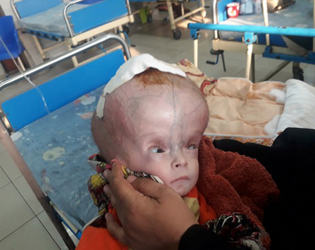 Baby with a ‘football’-sized head awaits life-changing surgery