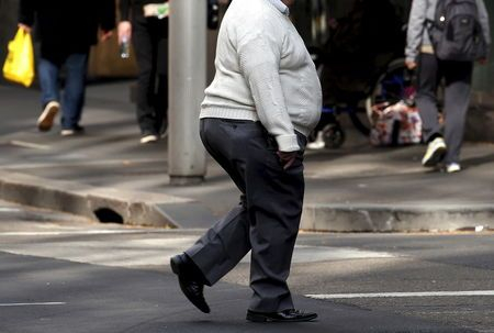 Stigma may keep people from getting weight loss surgery