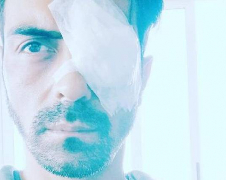 Bollywood actor Arjun Rampal suffers injuries
