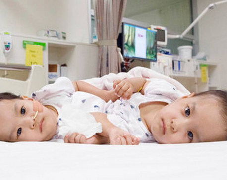 Separated Bhutanese twins recovering well in Australia