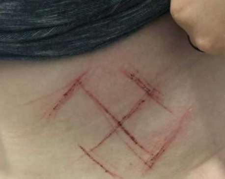 Brazil: Woman wearing #NotHim T-shirt attacked by Bolsonaro supporters, Swastika carved into skin