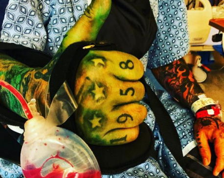 Motley Crue’s Nikki Sixx shares post-surgery photos