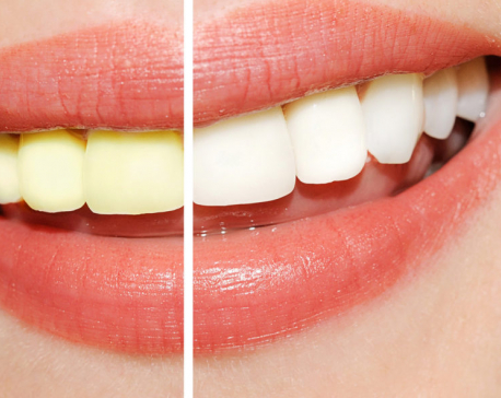 Try these food items to whiten your teeth naturally!