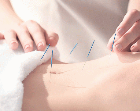 Understanding acupuncture