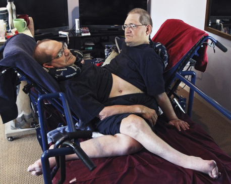 World’s longest-surviving conjoined twin brothers die at 68