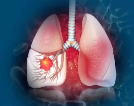 Lung Cancer Symptoms: Many Patients Experience Pain In These Parts Of The Face