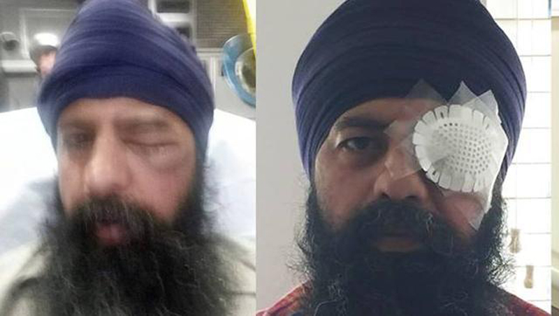 Sikh-American attacked by a group who removed his turban, cut off his hair