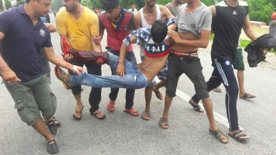 Updated: 8 hurt as police open fire on protesters in Kanchanpur