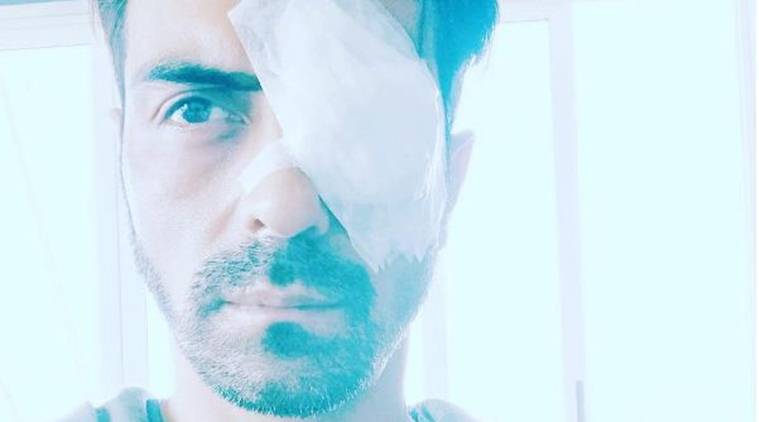 Bollywood actor Arjun Rampal suffers injuries