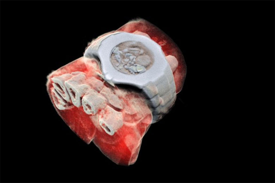 New Zealand scientists performs first 3D, color X-ray on a human
