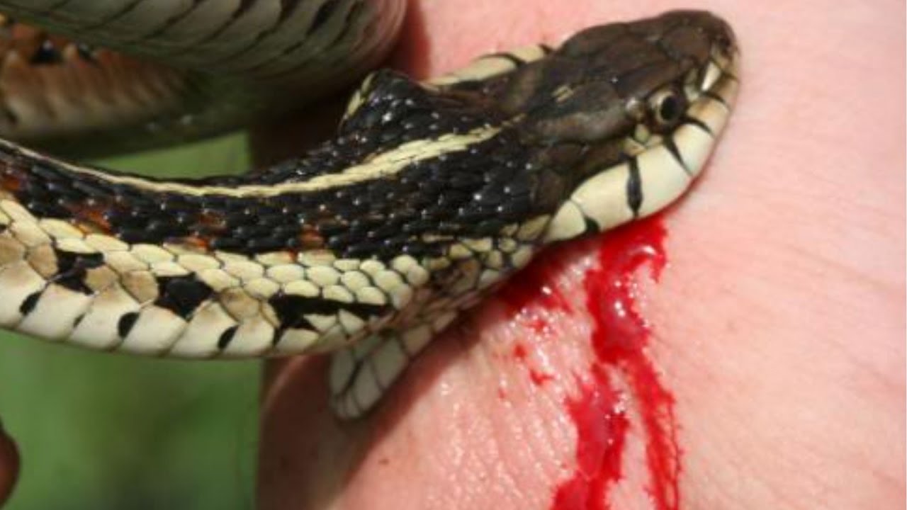 Snakebite menace in Bardibas