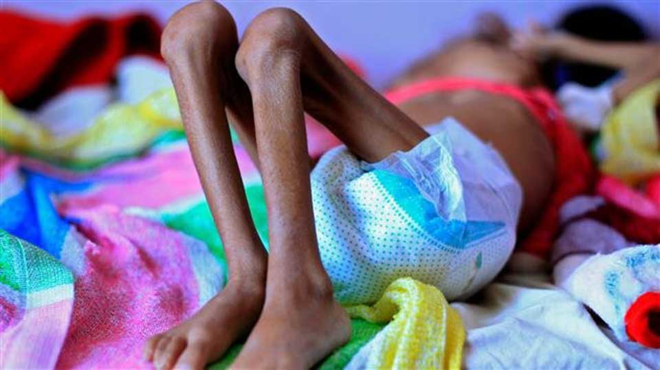 Half of Yemen population on brink of famine, 35 NGOs warn
