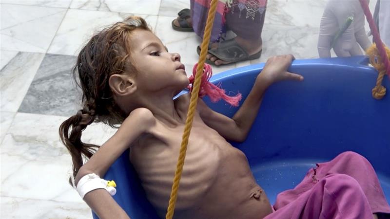 UN: 14 Million Yemenis could soon be at risk of starvation