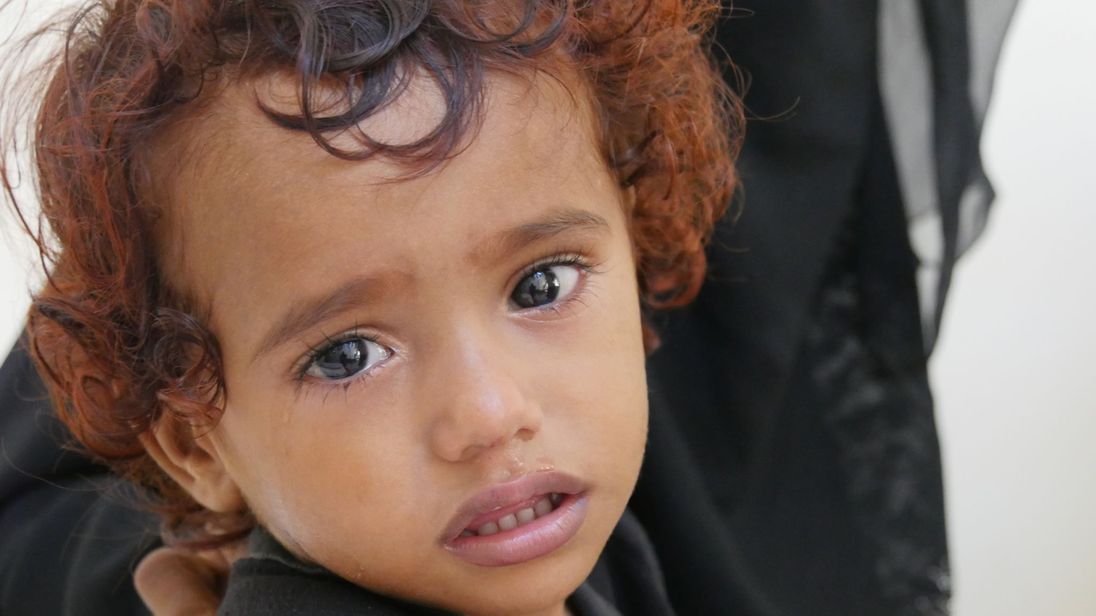 Yemen: Cholera surges by 170% in war-torn Hodeida