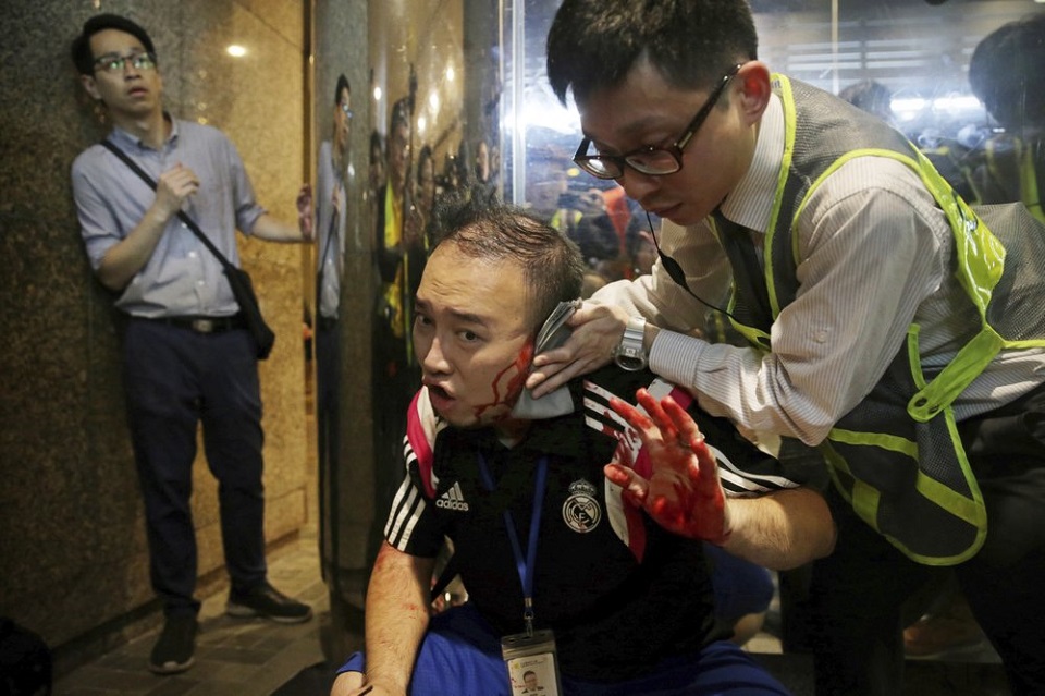 Attacker bites politician’s ear, others slashed in Hong Kong