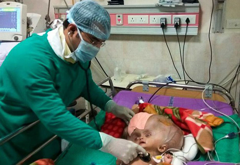 Boy with ‘world’s largest head’ undergoes surgery