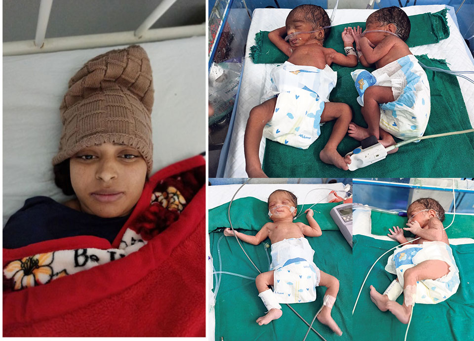 Quadruplets born in Pokhara