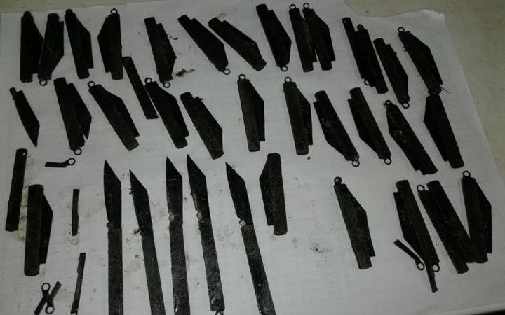 Surgeons in India remove 40 knives from man's stomach (with video)