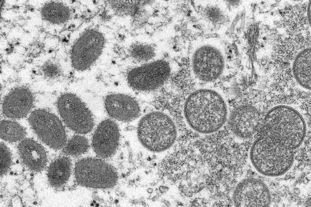 Take urgent measures to contain monkeypox outbreak