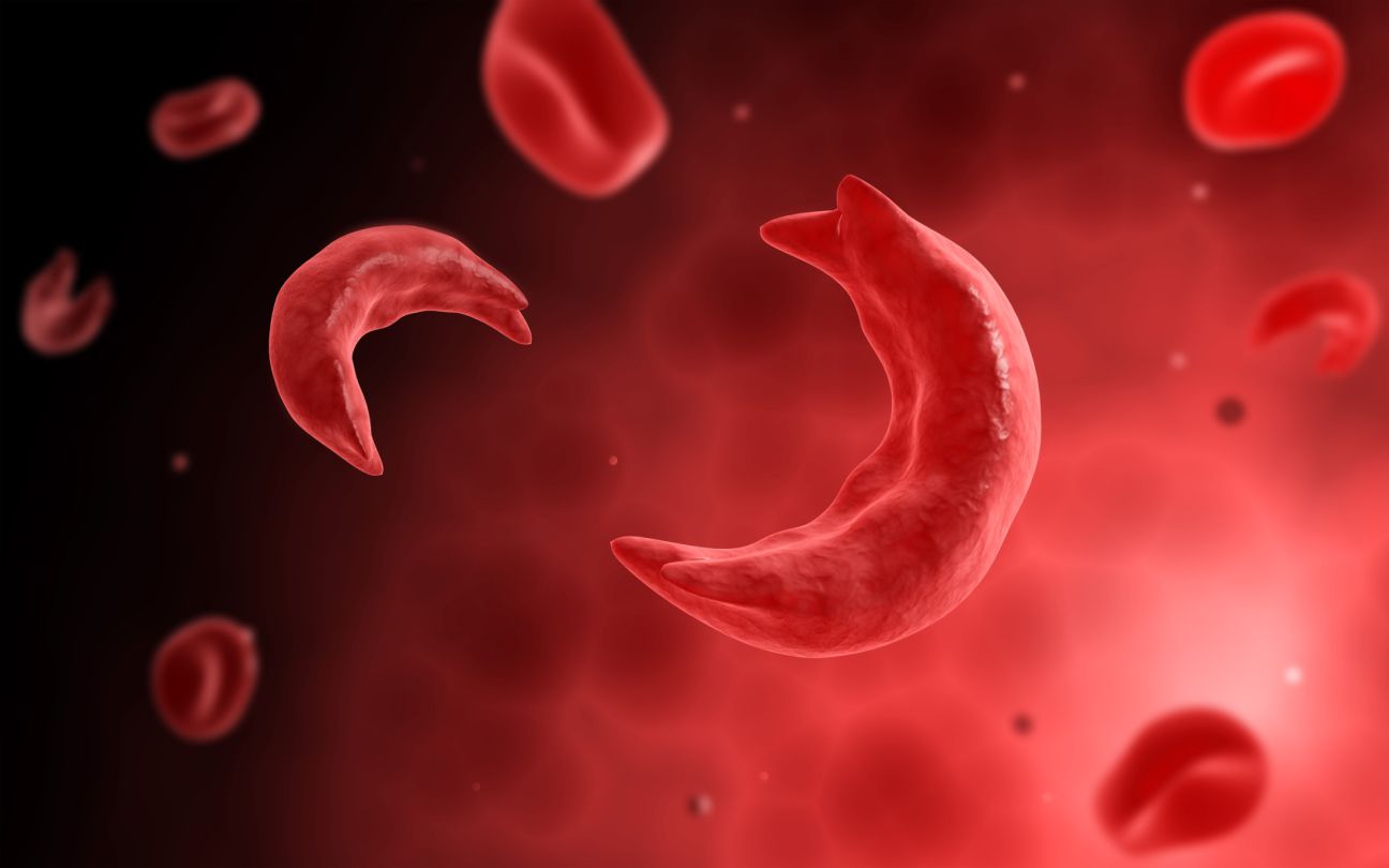 Sickle cell anemia widespread in Tharu community
