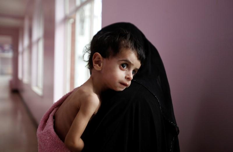 U.N. warns if no Yemen aid access, world will see largest famine in decades